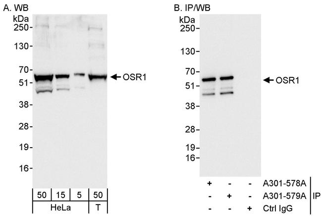 OSR1 Polyclonal Antibody (A301-579A)