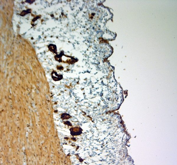 SLC4A1 Antibody in Immunohistochemistry (Paraffin) (IHC (P))