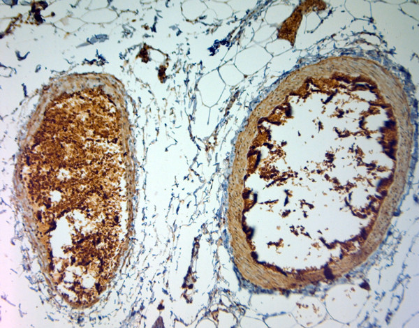 SLC4A1 Antibody in Immunohistochemistry (Paraffin) (IHC (P))