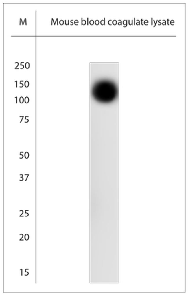 SLC4A1 Antibody in Western Blot (WB)