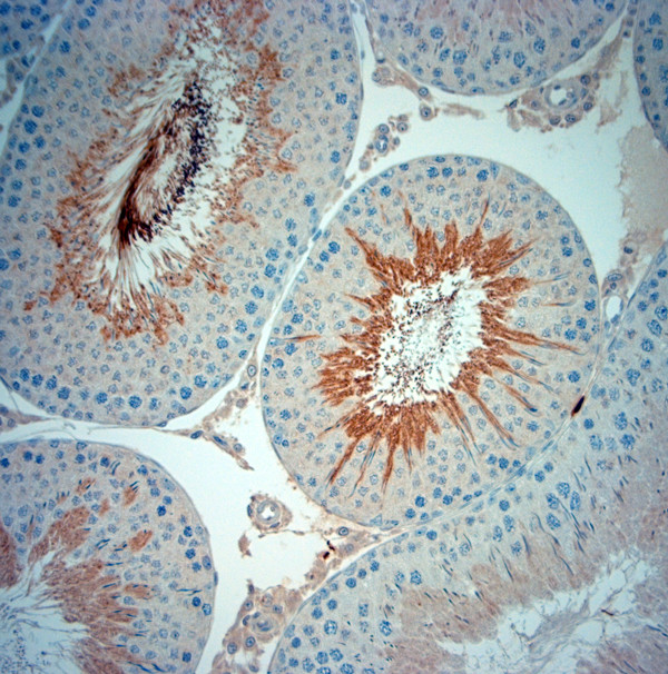 ISCA2 Antibody in Immunohistochemistry (Paraffin) (IHC (P))