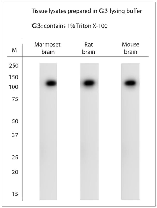 TRPA1 Antibody in Western Blot (WB)