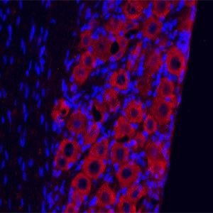 TrkC Antibody in Immunohistochemistry (IHC)