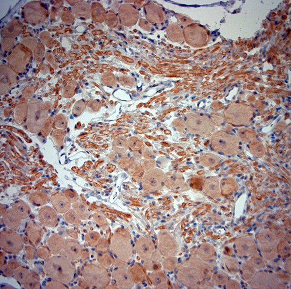 TrkB Antibody in Immunohistochemistry (Paraffin) (IHC (P))