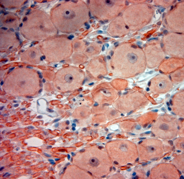 TrkB Antibody in Immunohistochemistry (Paraffin) (IHC (P))