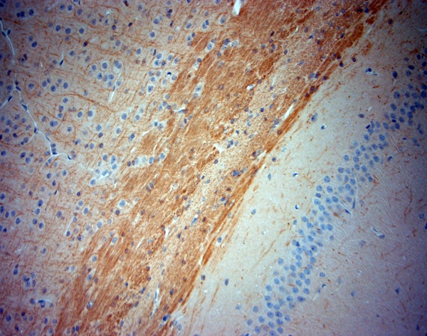 TrkB Antibody in Immunohistochemistry (Paraffin) (IHC (P))