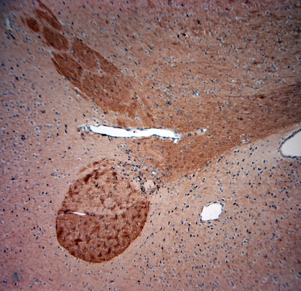 TrkB Antibody in Immunohistochemistry (Paraffin) (IHC (P))