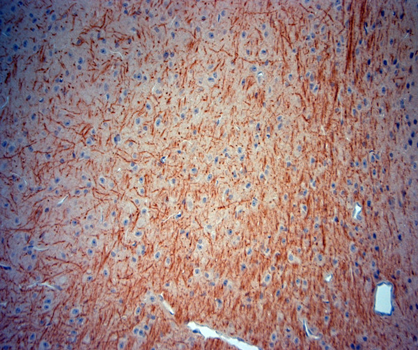 TrkB Antibody in Immunohistochemistry (Paraffin) (IHC (P))