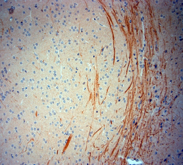 TrkB Antibody in Immunohistochemistry (Paraffin) (IHC (P))