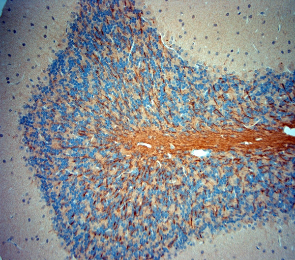 TrkB Antibody in Immunohistochemistry (Paraffin) (IHC (P))