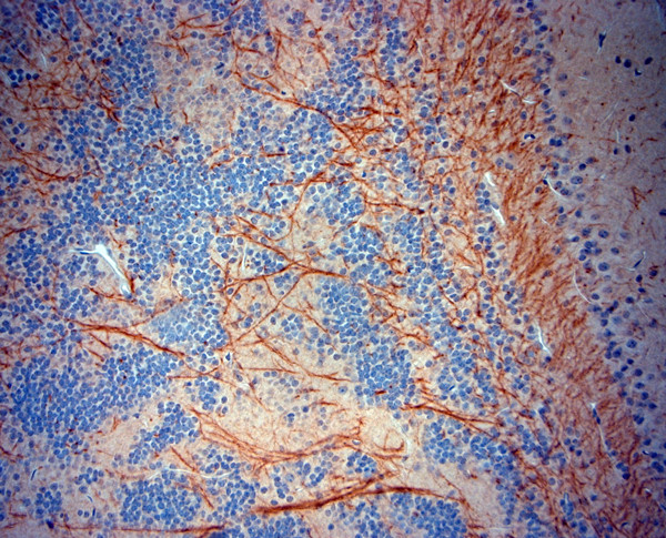 TrkB Antibody in Immunohistochemistry (Paraffin) (IHC (P))