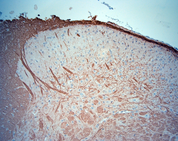 TrkB Antibody in Immunohistochemistry (Paraffin) (IHC (P))