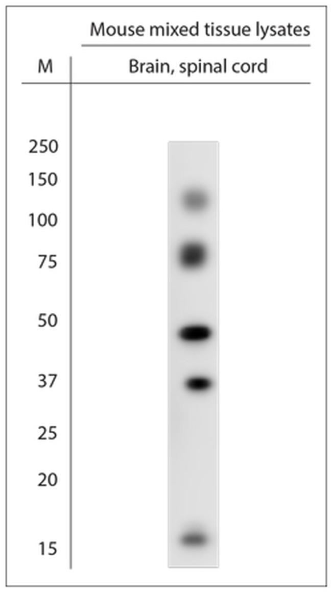 TrkB Antibody in Western Blot (WB)