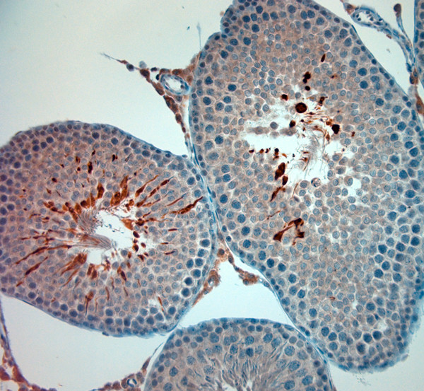 TRPM8 Antibody in Immunohistochemistry (Paraffin) (IHC (P))