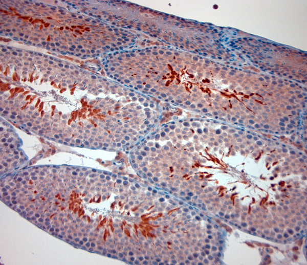 TRPM8 Antibody in Immunohistochemistry (Paraffin) (IHC (P))