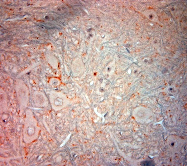 VMAT2 Antibody in Immunohistochemistry (Paraffin) (IHC (P))