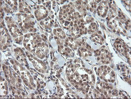 OTUB1 Antibody in Immunohistochemistry (Paraffin) (IHC (P))