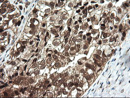 OTUB1 Antibody in Immunohistochemistry (Paraffin) (IHC (P))