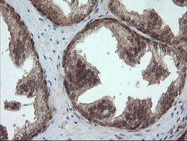 OTUB1 Antibody in Immunohistochemistry (Paraffin) (IHC (P))