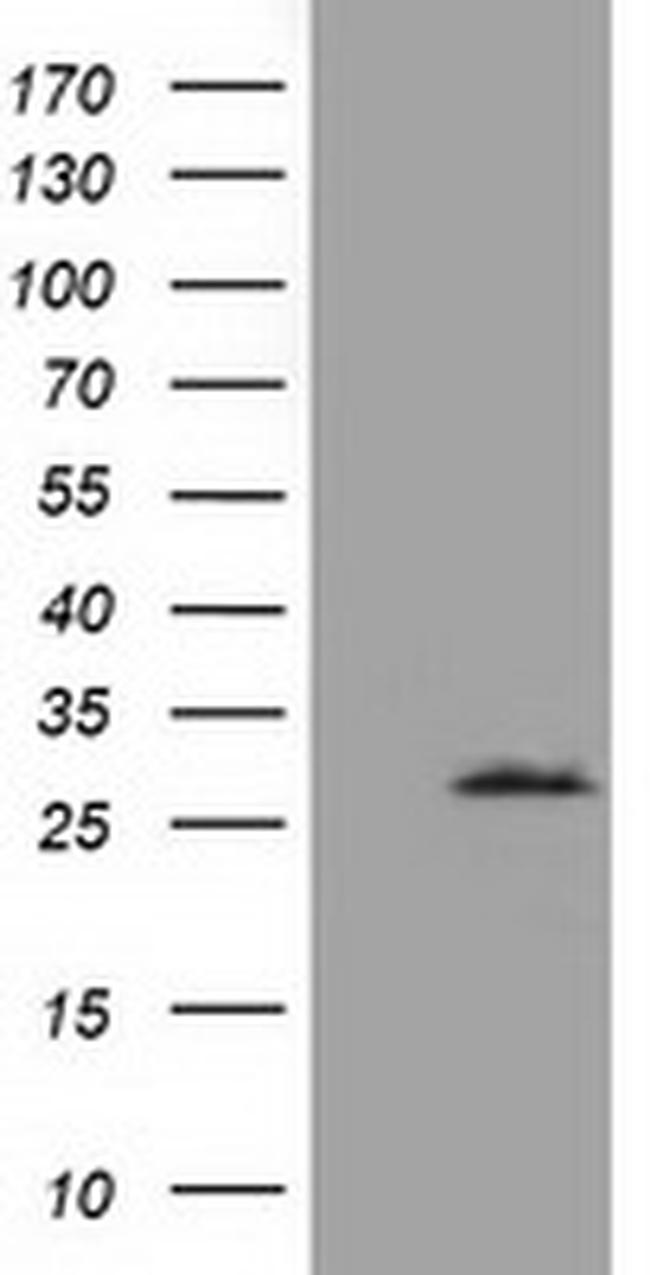 OTUB2 Antibody in Western Blot (WB)