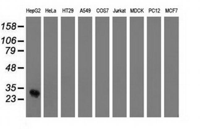 OTUB2 Antibody in Western Blot (WB)