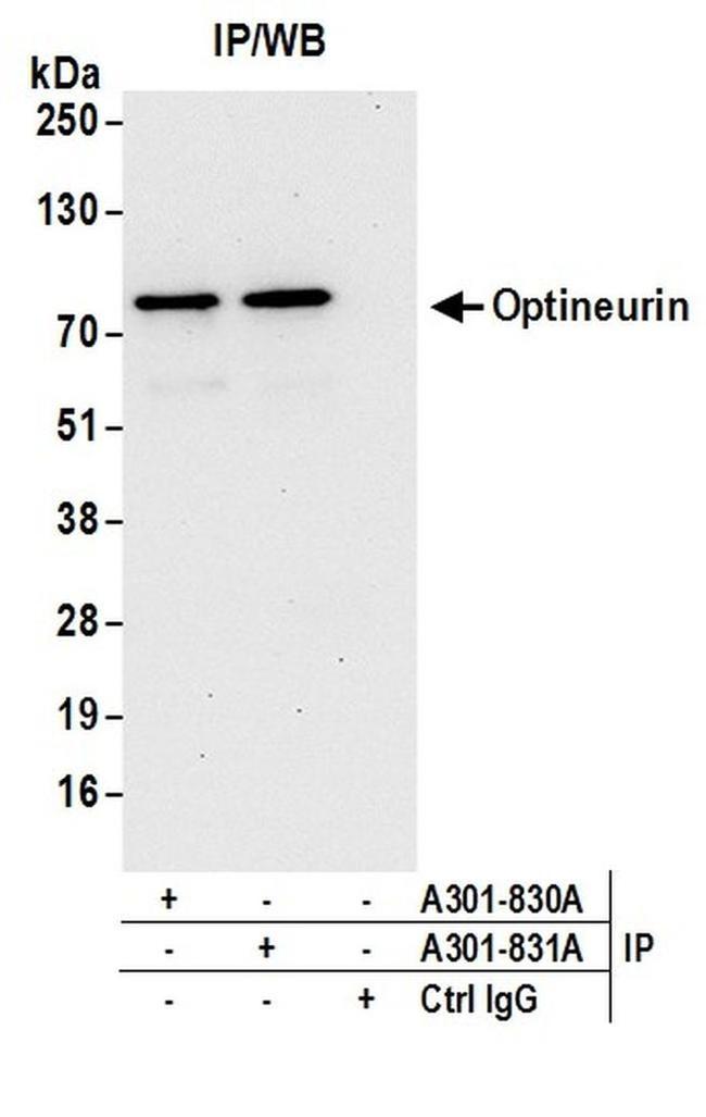 Optineurin Antibody in Western Blot (WB)