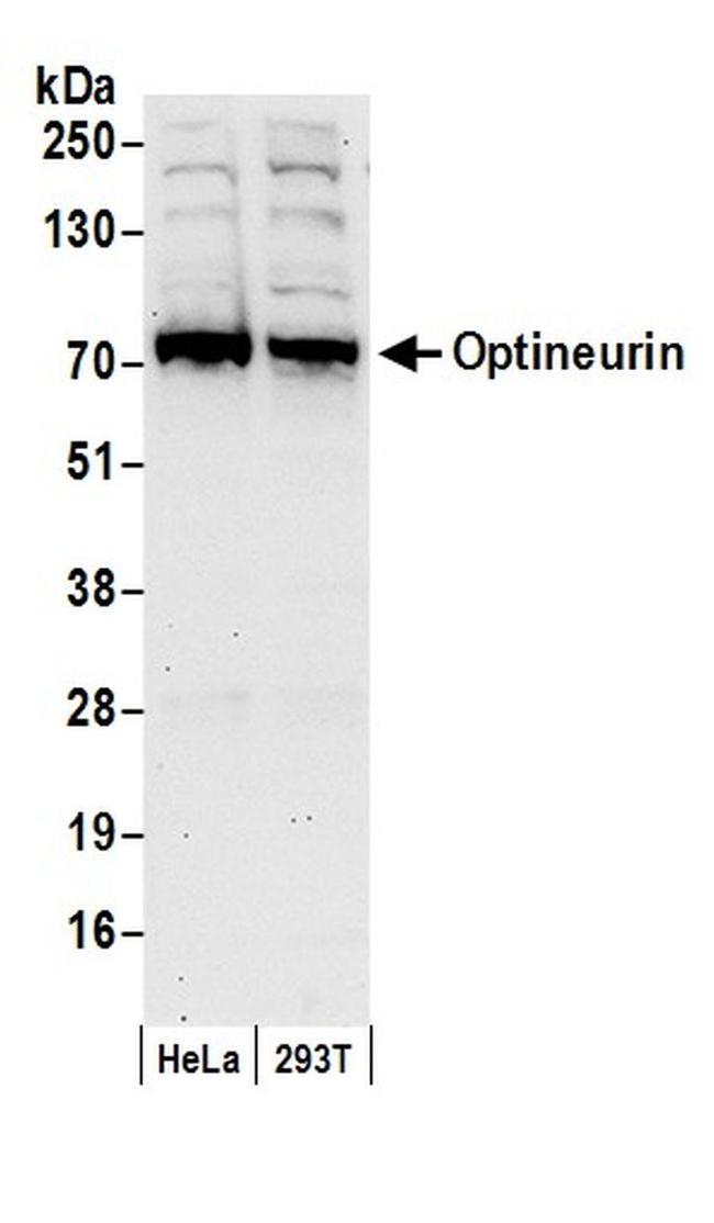 Optineurin Antibody in Western Blot (WB)