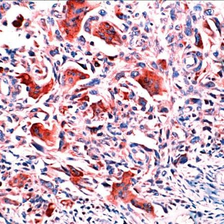 Osteopontin Antibody in Immunohistochemistry (IHC)