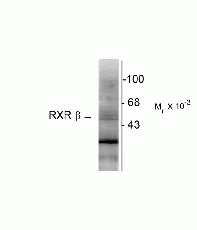 RXRB Antibody in Western Blot (WB)