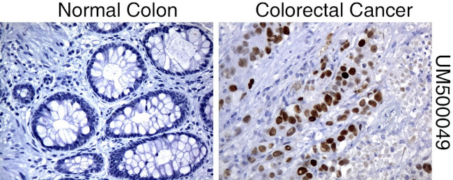 P53 Antibody in Immunohistochemistry (Paraffin) (IHC (P))