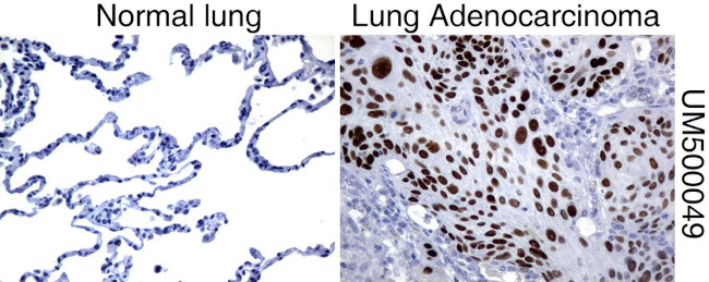 P53 Antibody in Immunohistochemistry (Paraffin) (IHC (P))