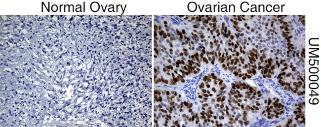 P53 Antibody in Immunohistochemistry (Paraffin) (IHC (P))