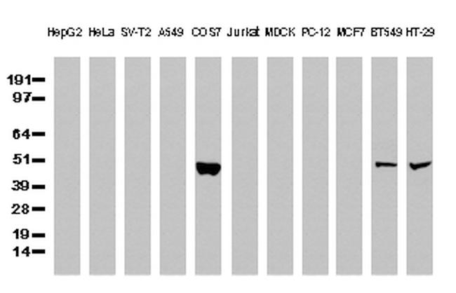 P53 Antibody in Western Blot (WB)