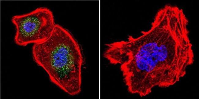 NFATC4 Antibody in Immunocytochemistry (ICC/IF)