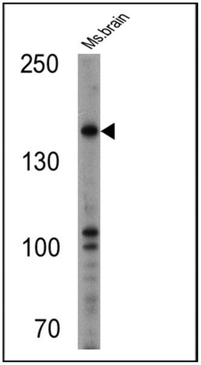 nNOS Antibody in Western Blot (WB)