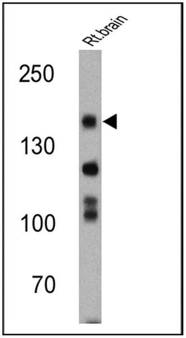 nNOS Antibody in Western Blot (WB)