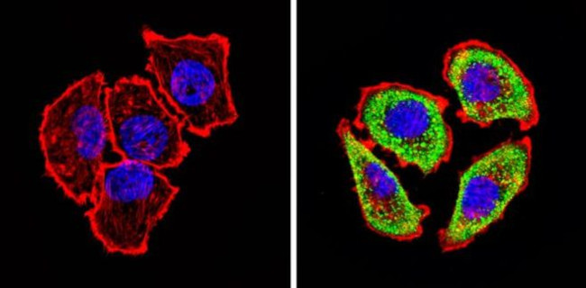 ADORA2A Antibody in Immunocytochemistry (ICC/IF)