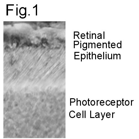 RAGE Antibody in Immunohistochemistry (IHC)