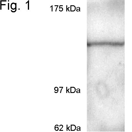 CRM1 Antibody in Western Blot (WB)