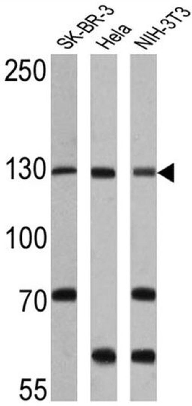 CRM1 Antibody in Western Blot (WB)