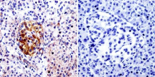 Cdc42 Antibody in Immunohistochemistry (Paraffin) (IHC (P))