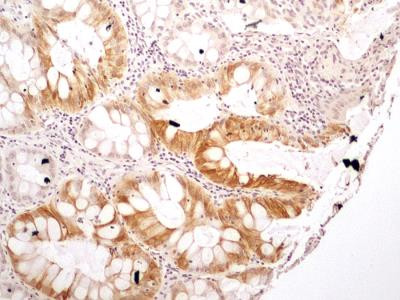 NTHL1 Antibody in Immunohistochemistry (Paraffin) (IHC (P))