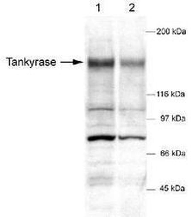 Tankyrase Antibody in Western Blot (WB)