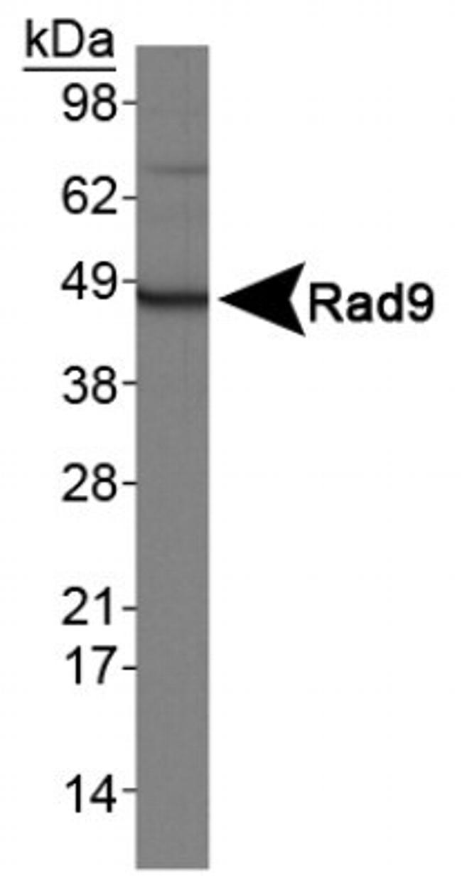 RAD9 Antibody in Western Blot (WB)