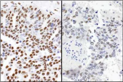 53BP1 Antibody in Immunohistochemistry (Paraffin) (IHC (P))