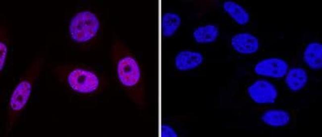 53BP1 Antibody in Western Blot (WB)