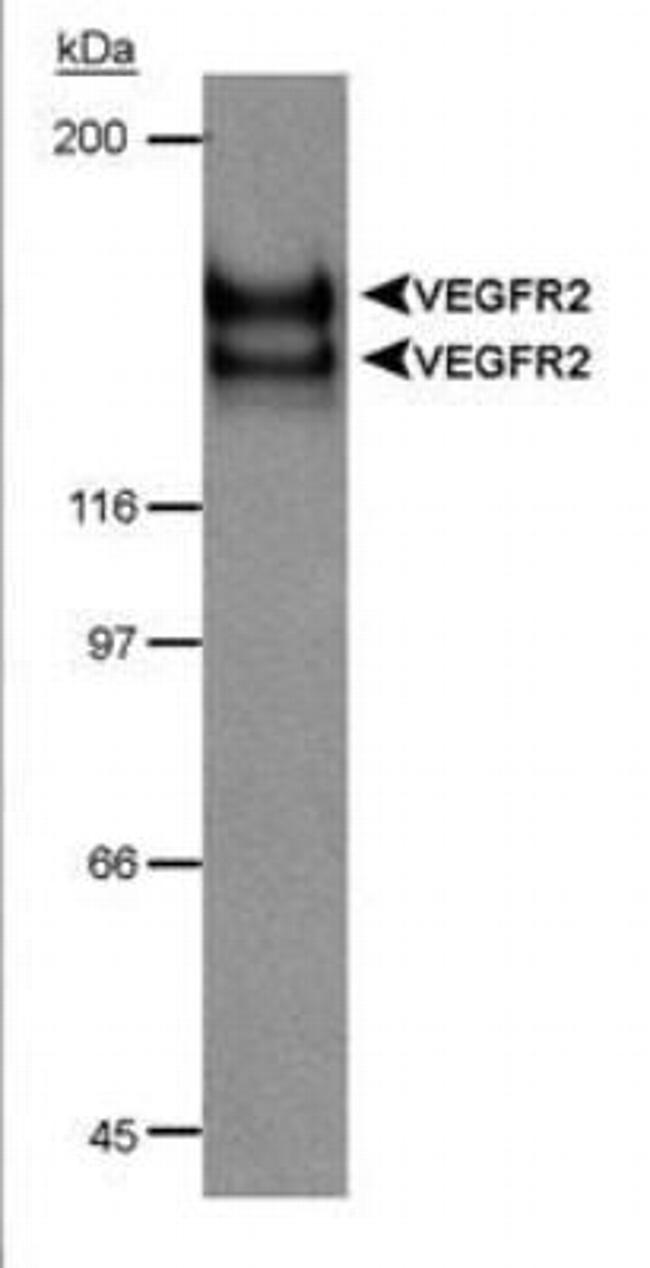 VEGF Receptor 2 Antibody in Western Blot (WB)