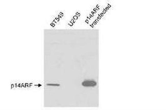 p14ARF Antibody in Western Blot (WB)