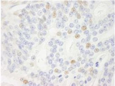 p14ARF Antibody in Immunohistochemistry (Paraffin) (IHC (P))