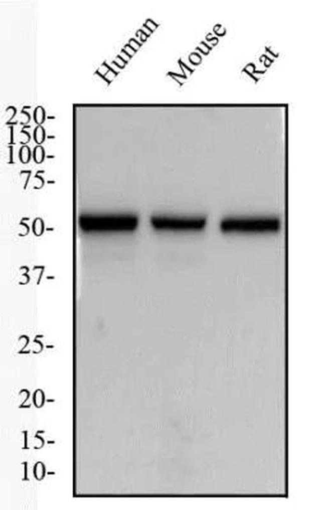 TACR1 Antibody in Western Blot (WB)